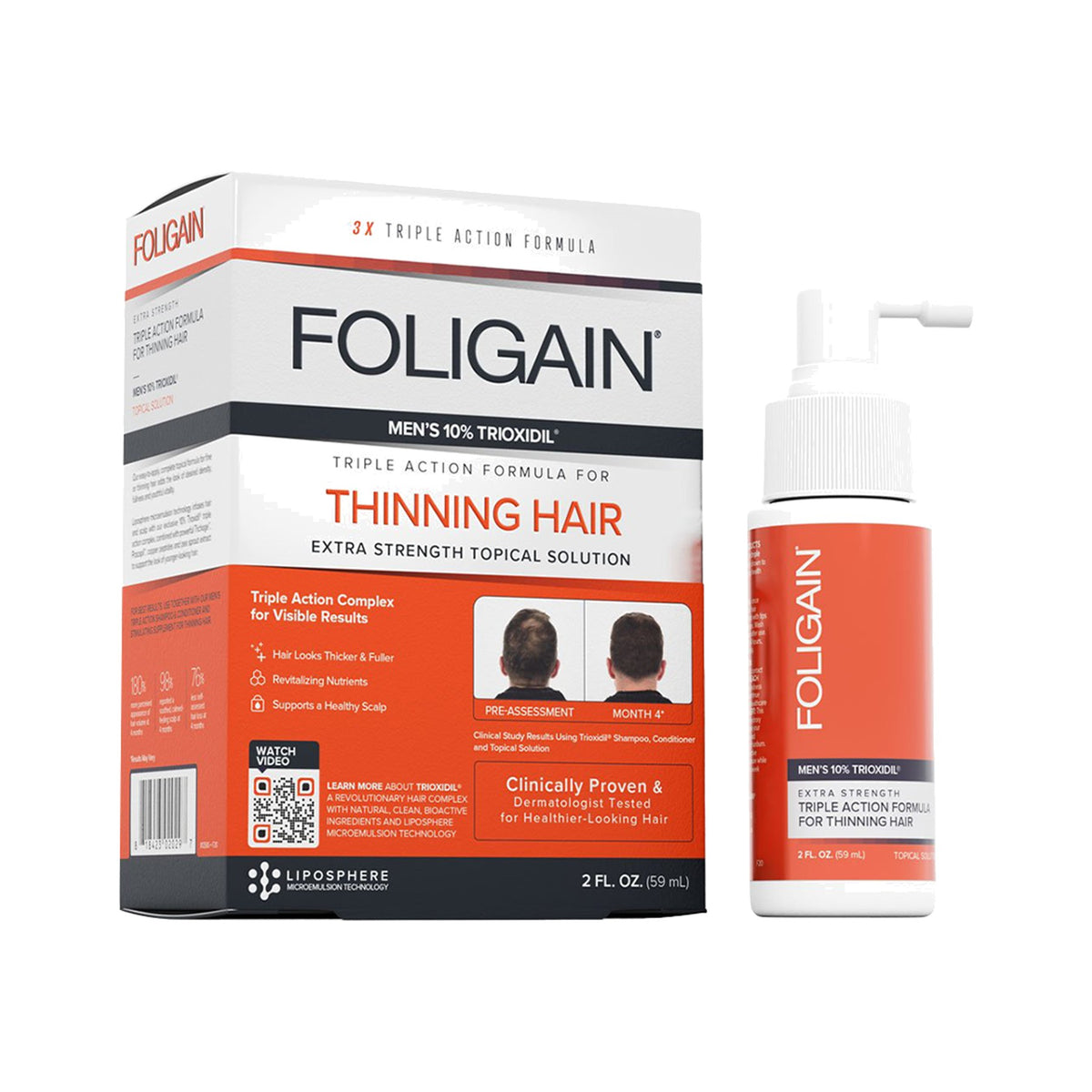 Foligain Hair Loss Lotion for Men 59ml – Minoxidil-Free